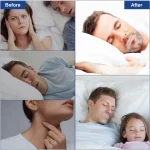 خرید چسب دهان مخصوص خواب از دبی